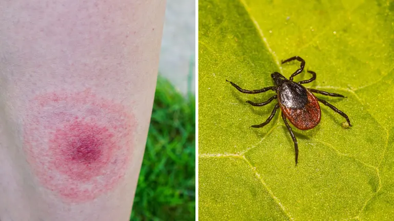 “Puntura di zecca: cosa devi sapere” Indicazioni utilissime per gli escursionisti del Laceno